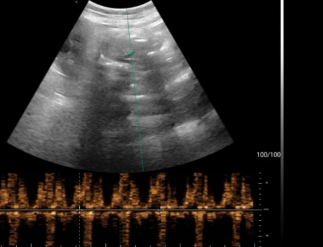 Batimento cardiofetal