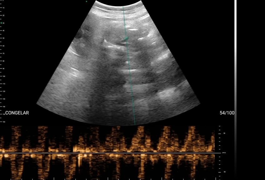Modo M batimento cardiofetal