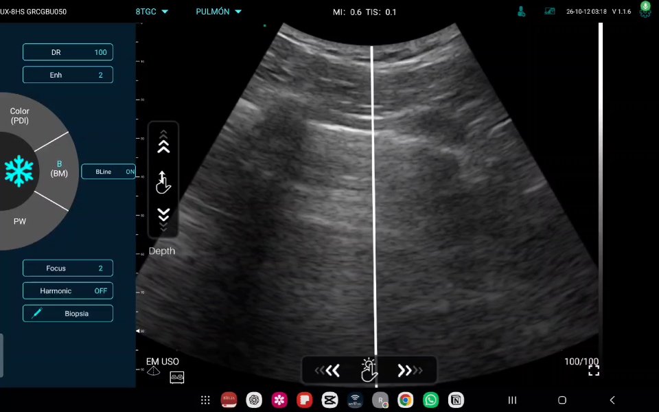 Avaliação pulmonar